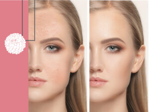Dermatóloga Certificada