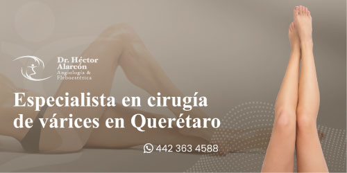 Escleroterapia en Querétaro