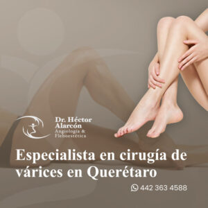 Escleroterapia en Querétaro > Dr. Héctor Alarcón