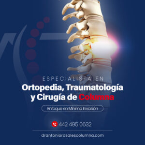 Cirujano de Columna en Querétaro  ▷ Dr. Antonio Rosales Mares | Corregidora